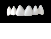 Cod.E5UPPER ANTERIOR : 10x  wax facings-bridges (hollow), MEDIUM, Tapering ovoid, (13-23), compatible with solid (not  hollow) wax bridges Cod.S5UPPER ANTERIOR, (13-23)